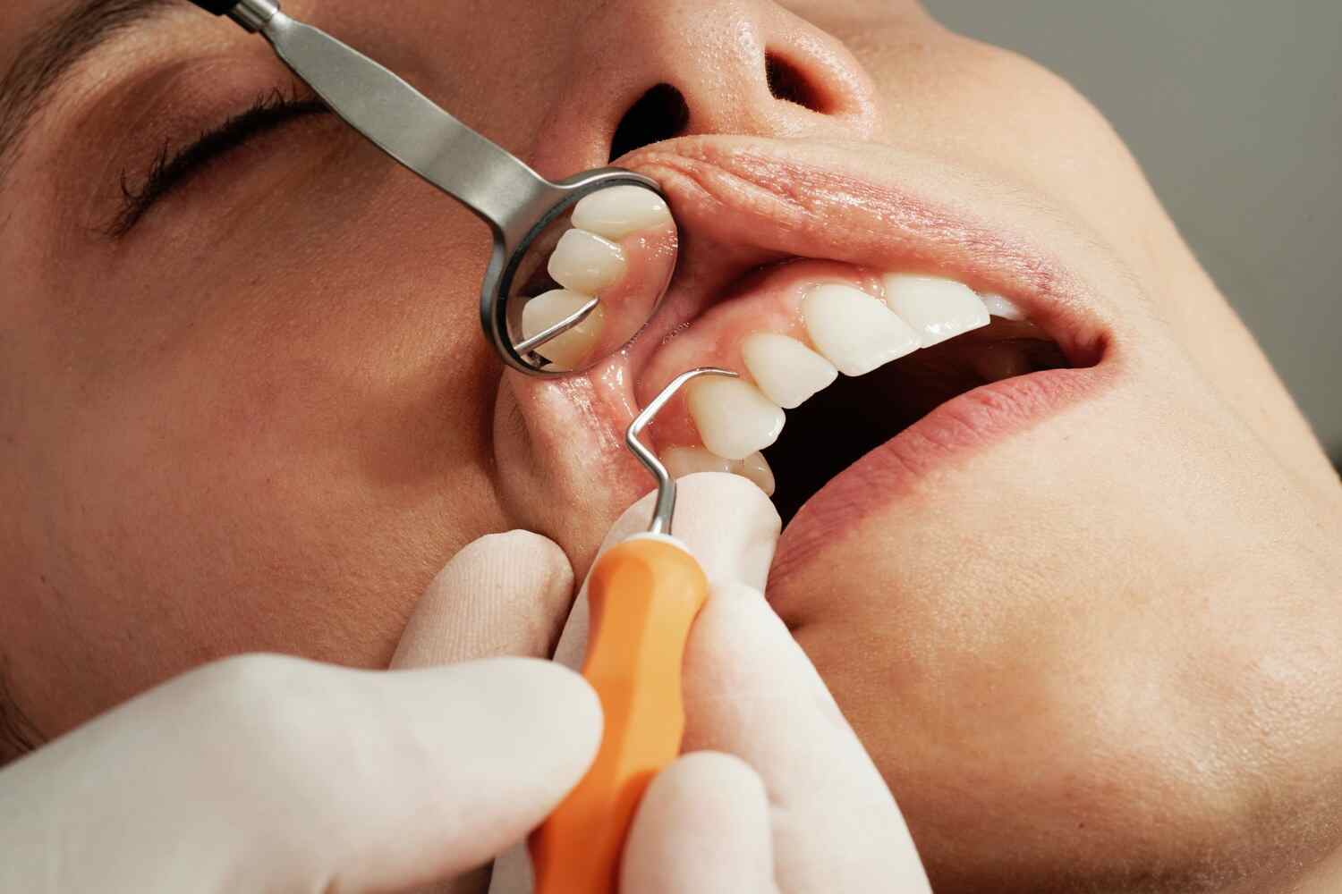dental proceedure