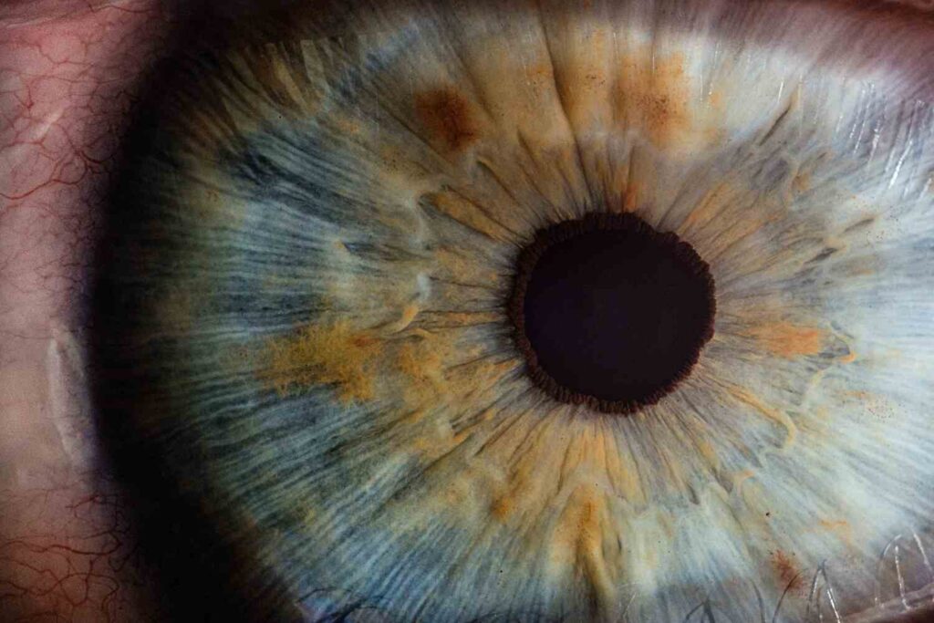 pupil with a blue iris