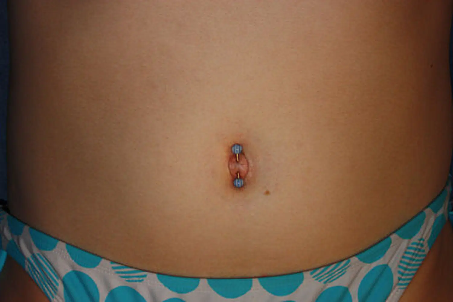 outie belly button piercing