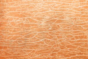 abstract art of cracked skin